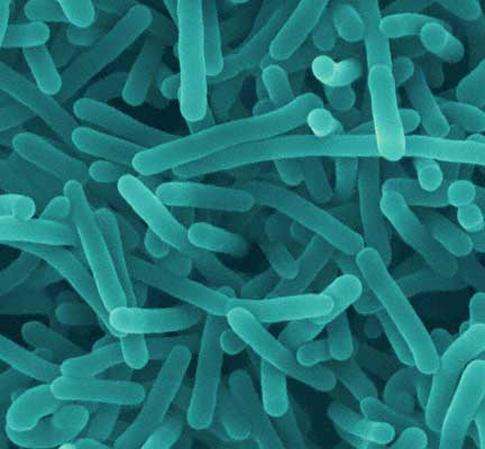 How do you know if you have a listeria infection?